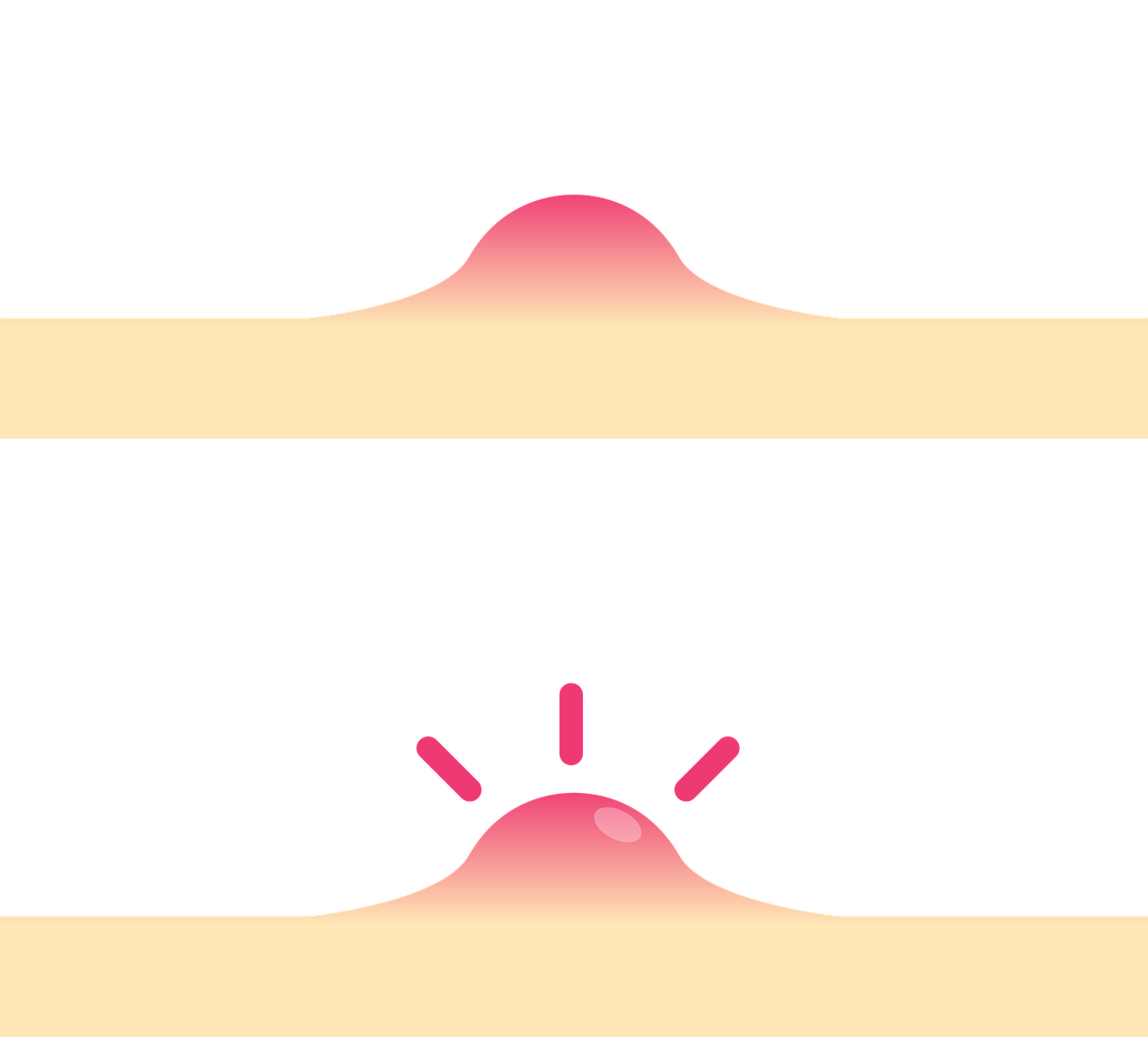 ontdek effectieve oplossingen en tips voor het beheersen van acne. leer meer over de oorzaken, behandelingen en hoe je een gezonde huid kunt behouden.